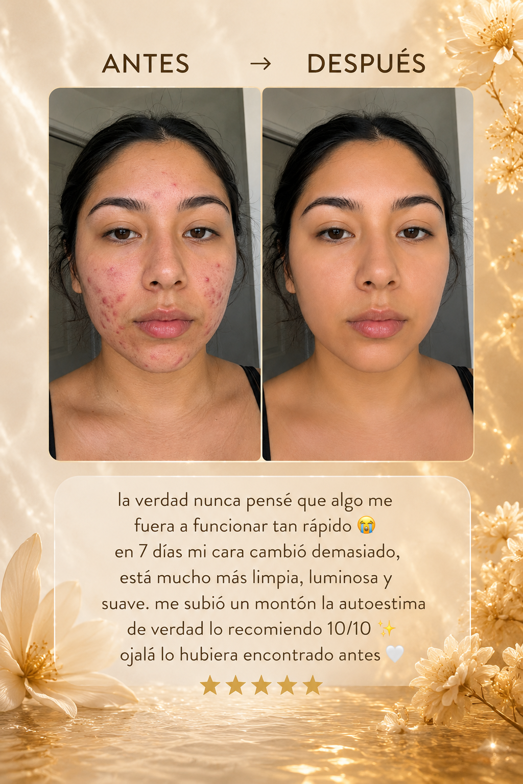 Aura Skin - ¡Vuelve a disfrutar de tu piel!